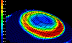 corneal topography
