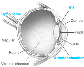 glaucoma eye
